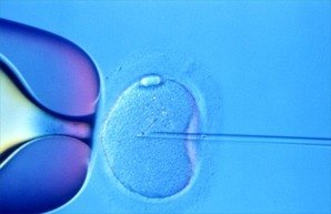 Intracytoplasmic sperm injection ICSI